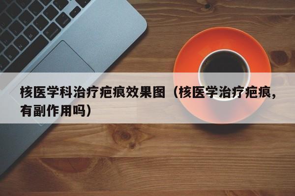 核医学科治疗疤痕效果图（核医学治疗疤痕,有副作用吗）  第1张